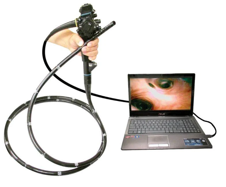 آندوسکوپ های شلنگی