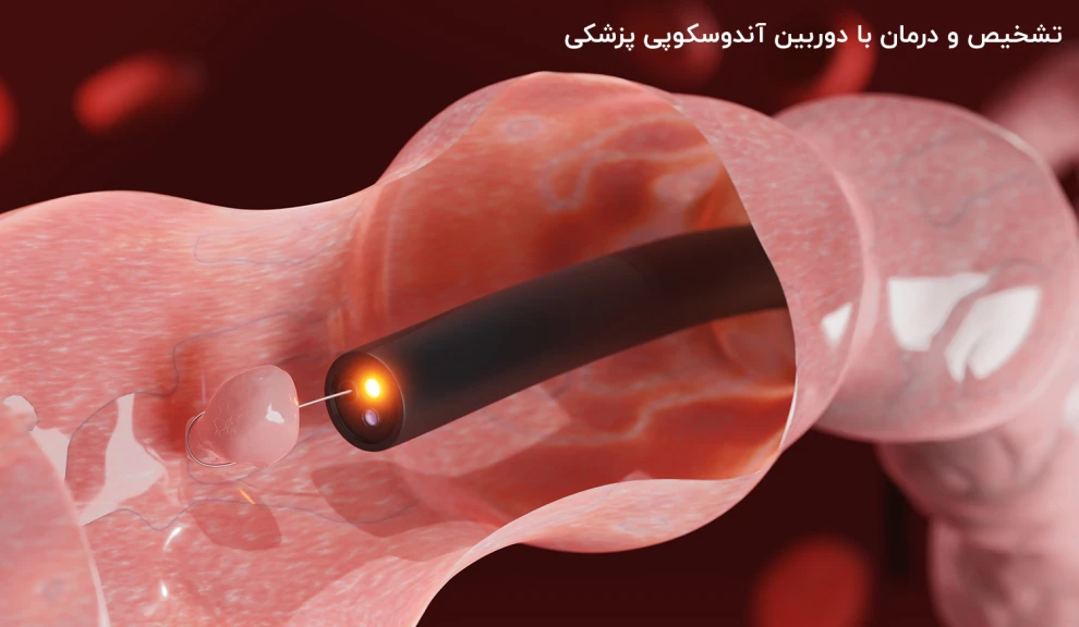 شخیص و درمان